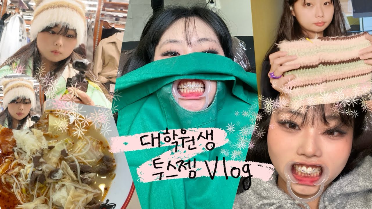 대학원생 브이로그 ((💎🦷투스젬 하는 날🦷💎)) 두근😇🩵