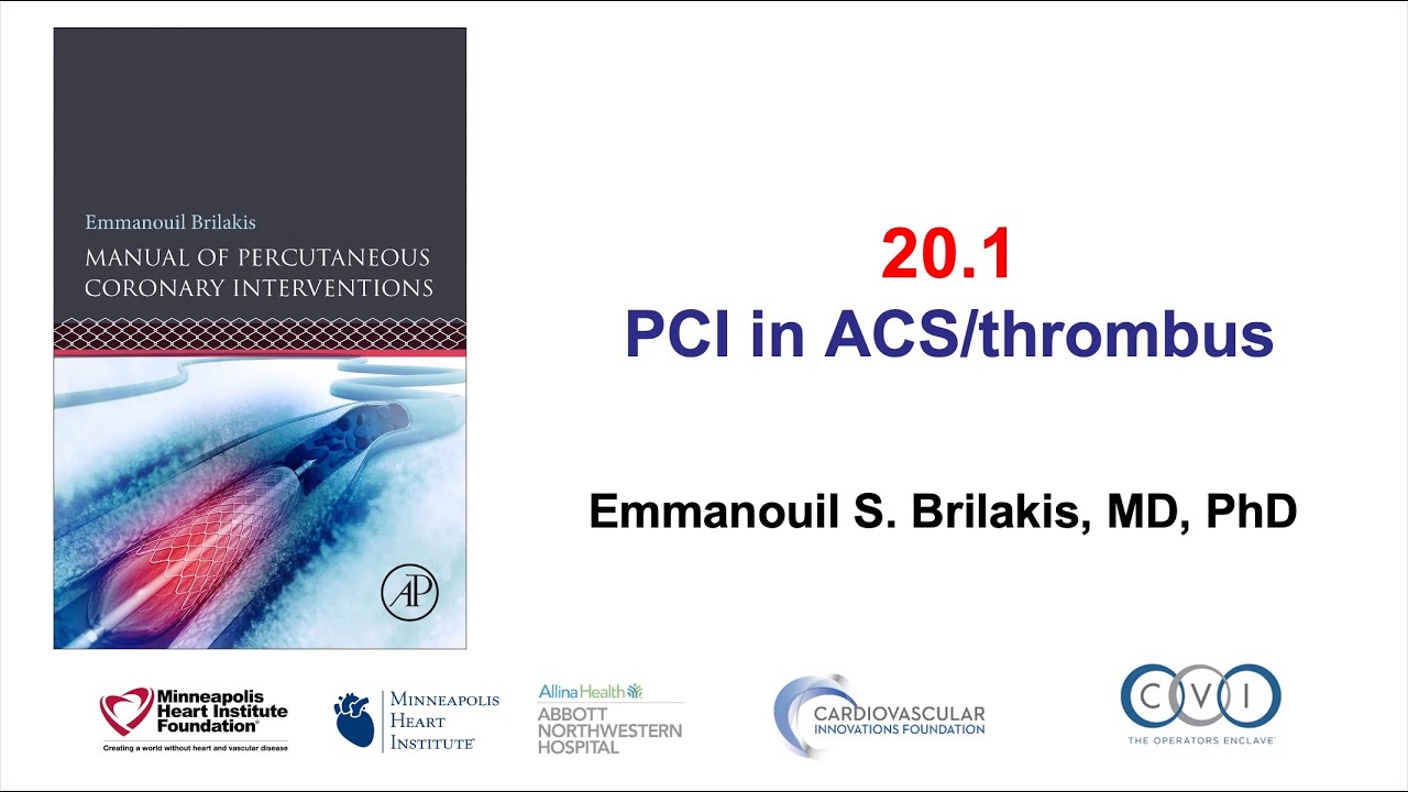 20.1 PCI in ACS patients: Manual of PCI