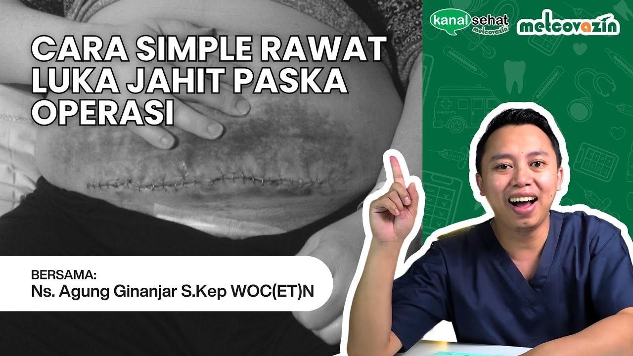TUTORIAL MERAWAT LUKA JAHIT PASKA OPERASI BIAR TIDAK BERNANAH | Kanal Sehat by Metcovazin