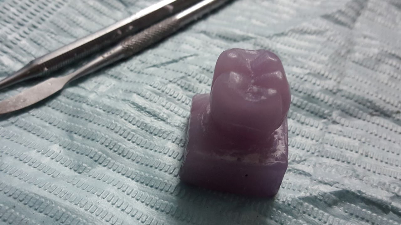 Carving mandibular first molar