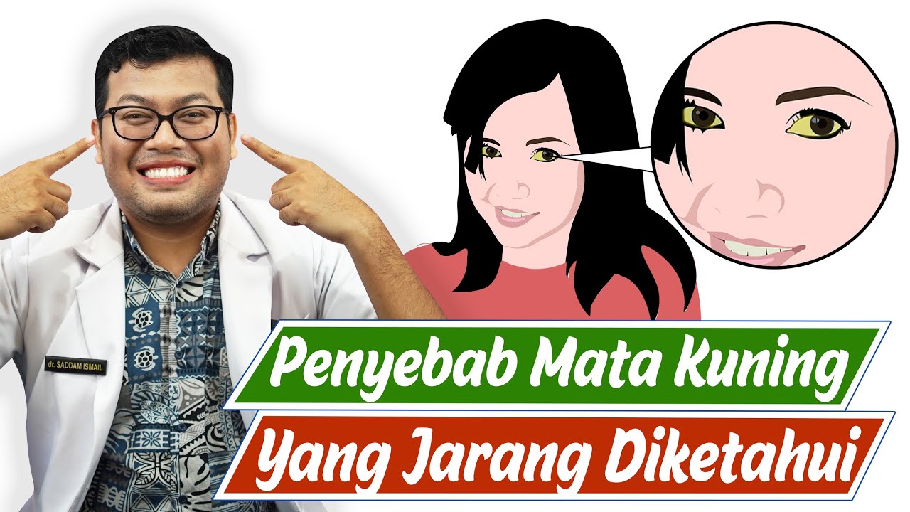 PENYEBAB MATA KUNING YANG HARUS DIKETAHUI - DOKTER SADDAM ISMAIL