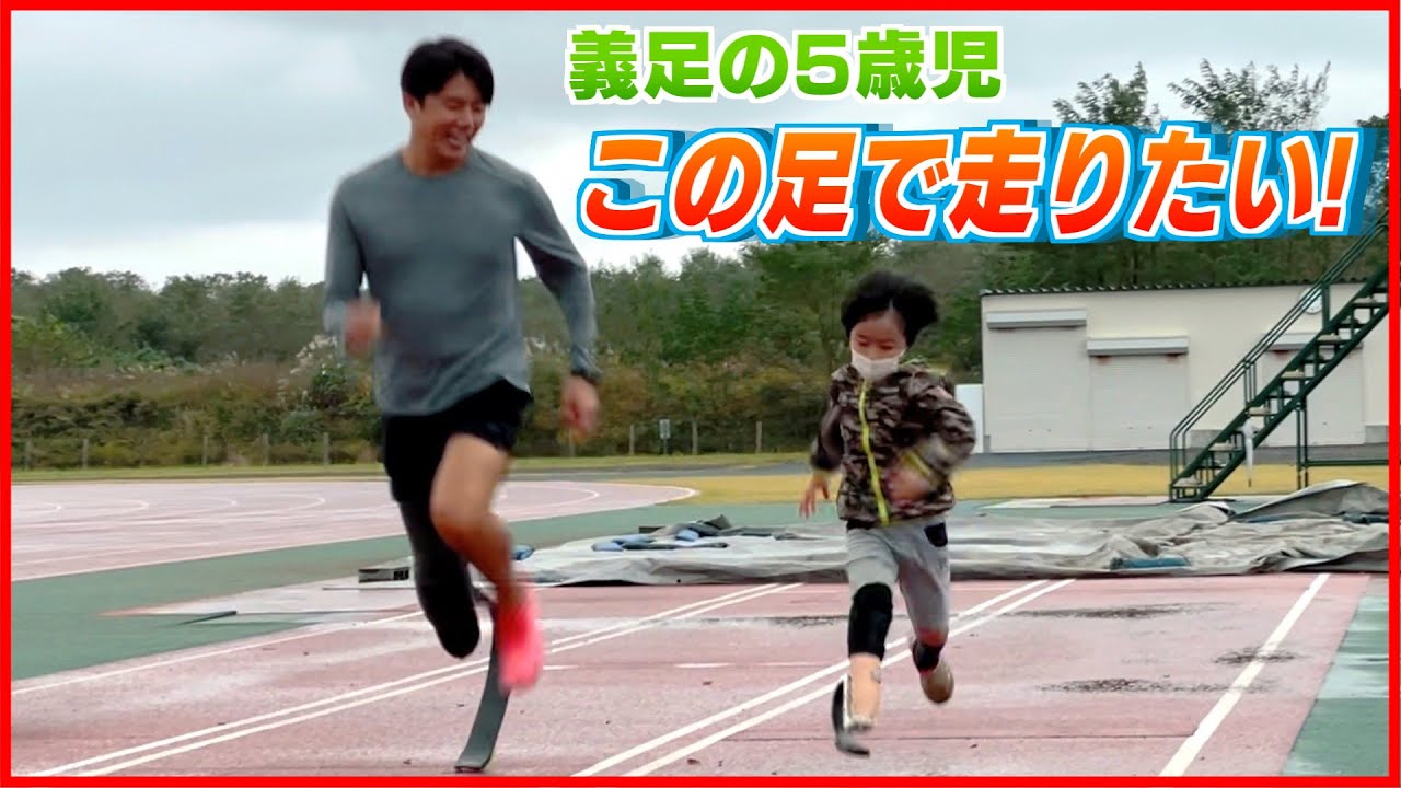 義足の5歳児「この足で走りたい！」夢を叶えたスポーツ義足とは　《新潟》