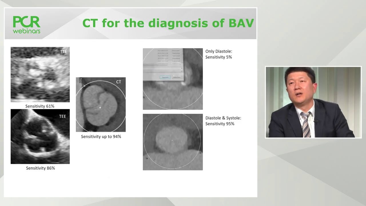 TAVI in bicuspid valve disease - PCR Webinar Round Table