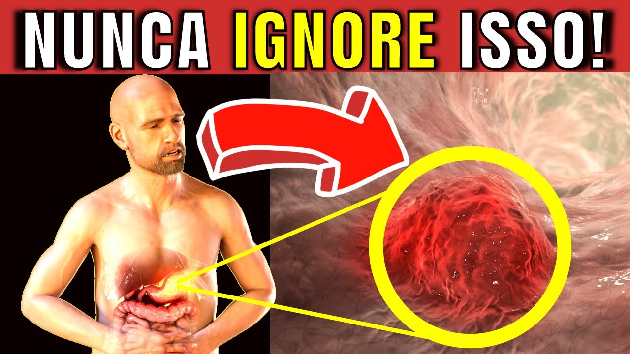 7 SINTOMAS de ALERTA de C&Acirc;NCER DE EST&Ocirc;MAGO | N&Atilde;O Ignore esses sinais Antes que Seja Tarde Demais!