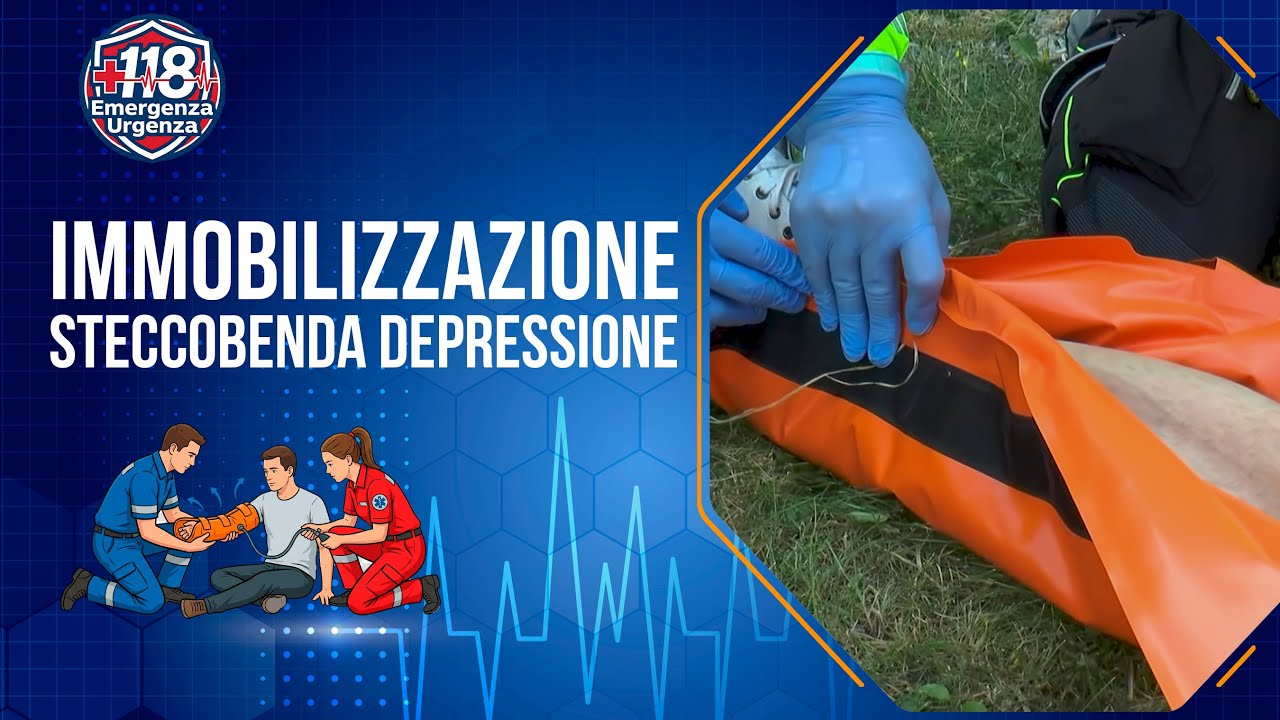 Immobilizzazione Frattura Arto con Steccobenda | Protocollo AREU