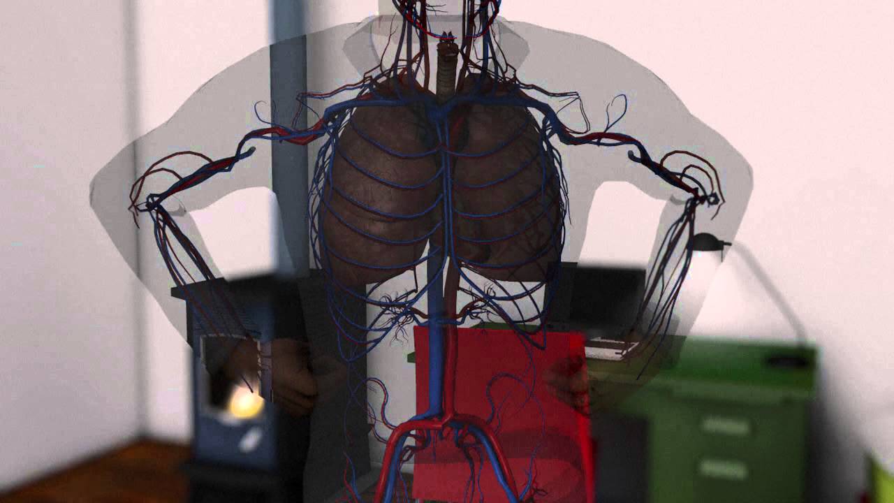 La intoxicaci&oacute;n por mon&oacute;xido de carbono