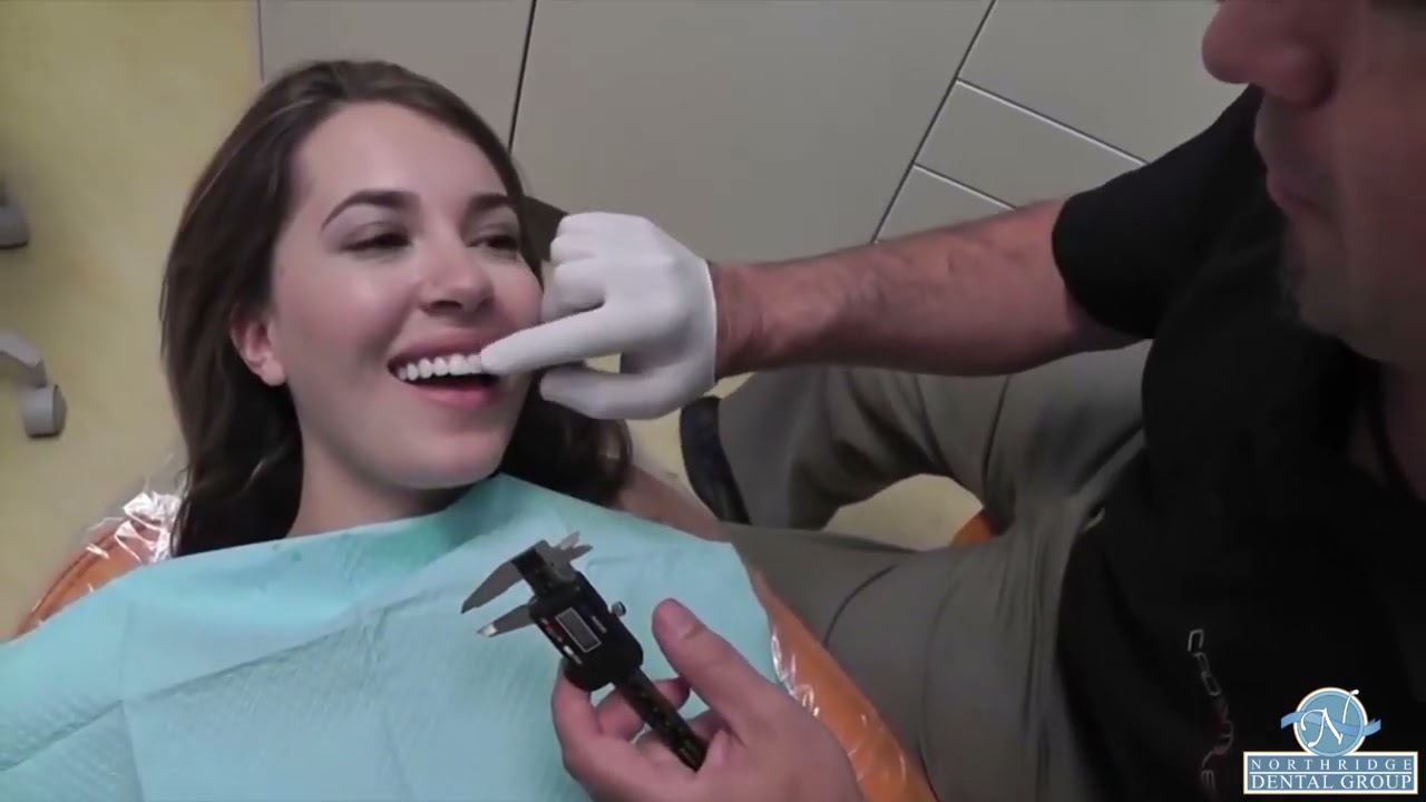 What are Veneers? What are They? Learn about how Northridge Dental Group does them