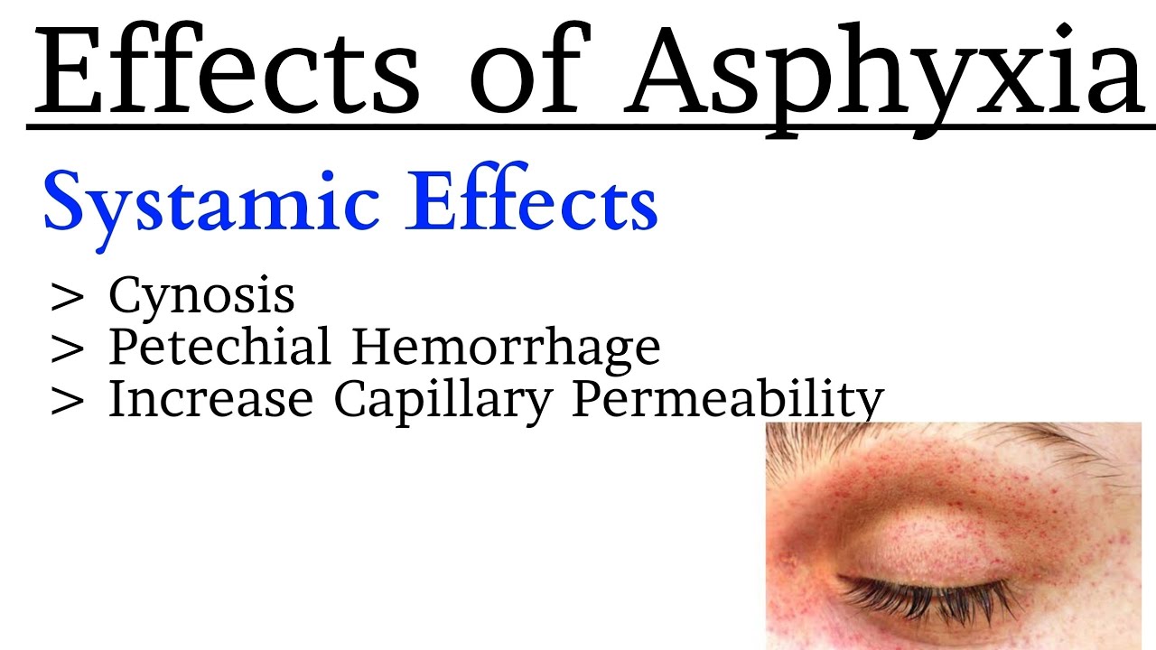 Effects of Asphyxia || Cynosis, Incresed vascular permeability and petechial haemorrhage