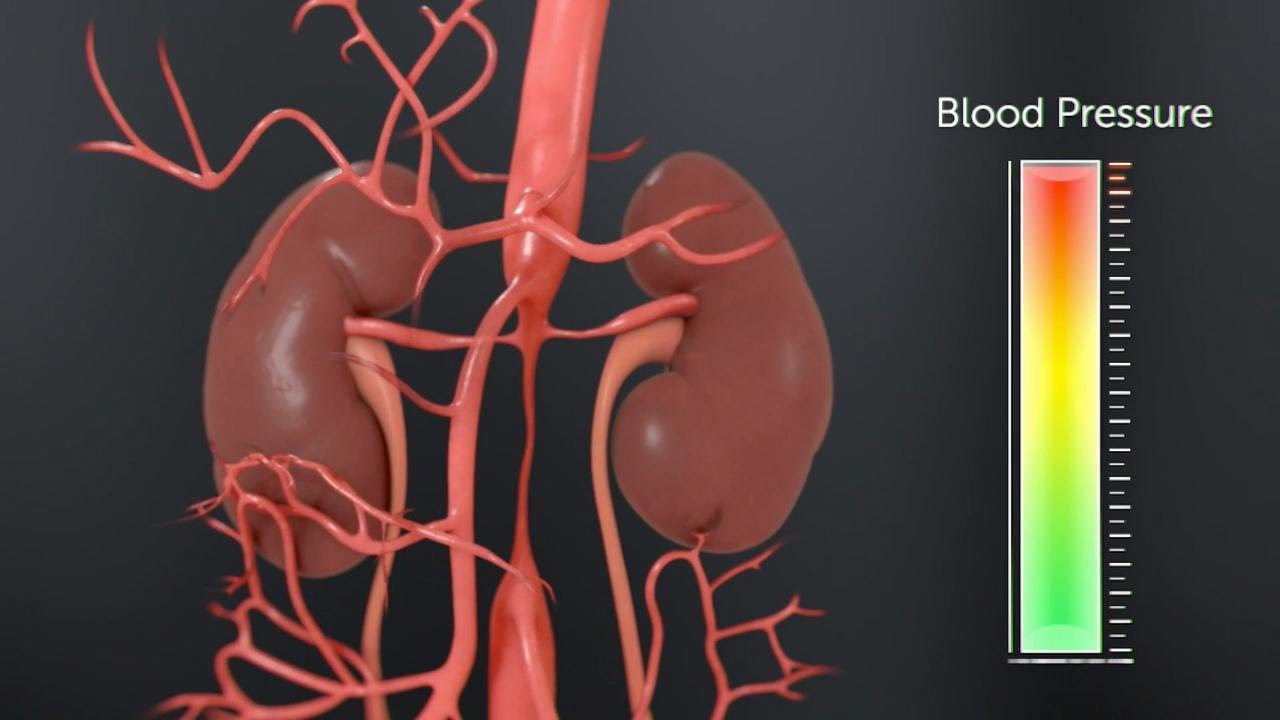 What is Midaortic Syndrome | Boston Children's Hospital