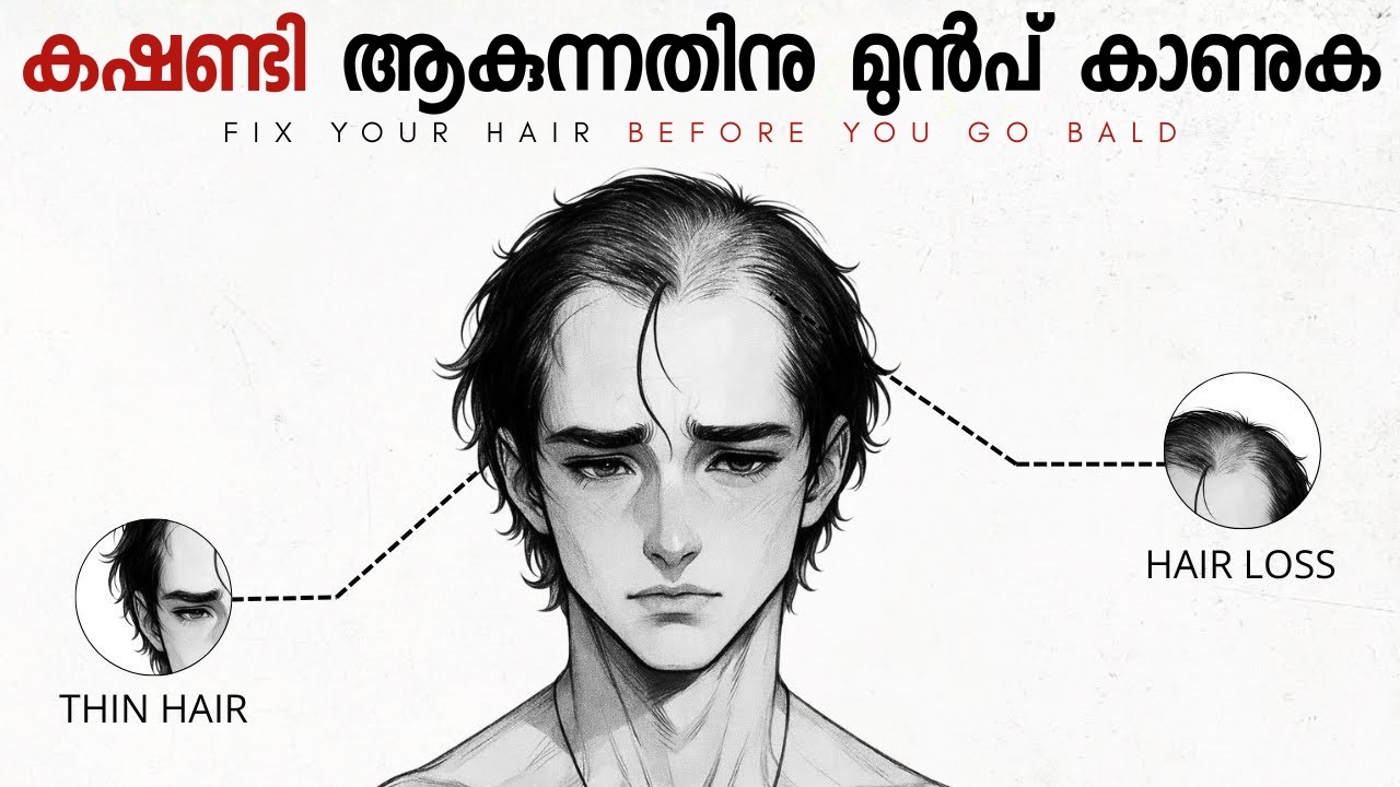 The Ultimate Hair Tranformation Guide For Men FIX YOUR HAIR BEFORE YOU GO BALD