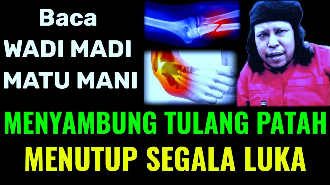 MENYAMBUNG TULANG PATAH DAN MENUTUP SEGALA LUKA BACA WADI MADI MATU MANI
