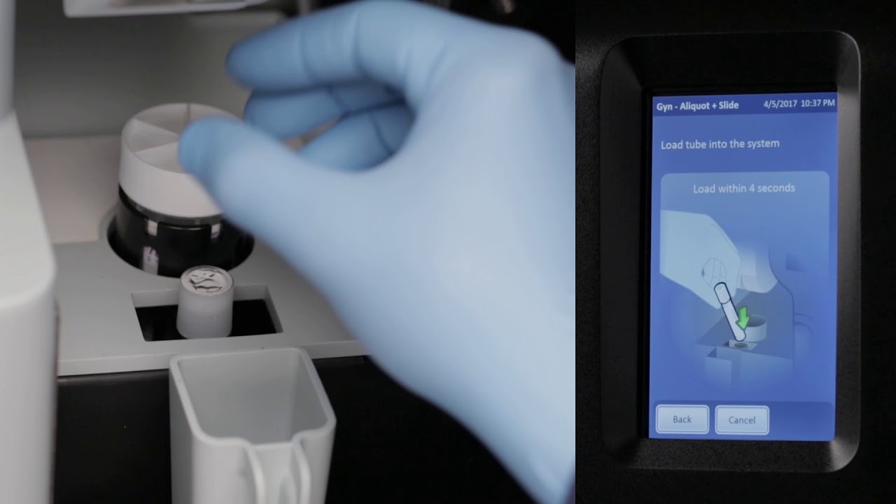 ThinPrep® Genesis Processor