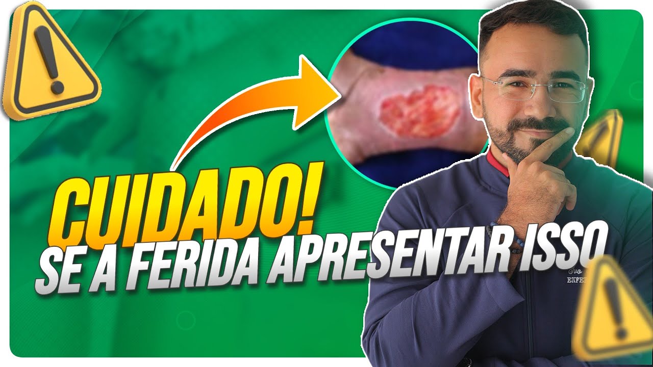 5 SINAIS QUE A FERIDA N&Atilde;O VAI CICATRIZAR! (o 5&ordm; &eacute; o PIOR😱)
