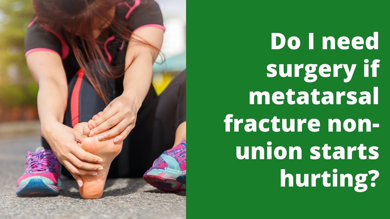 Do I need surgery if metatarsal fracture non union starts hurting?