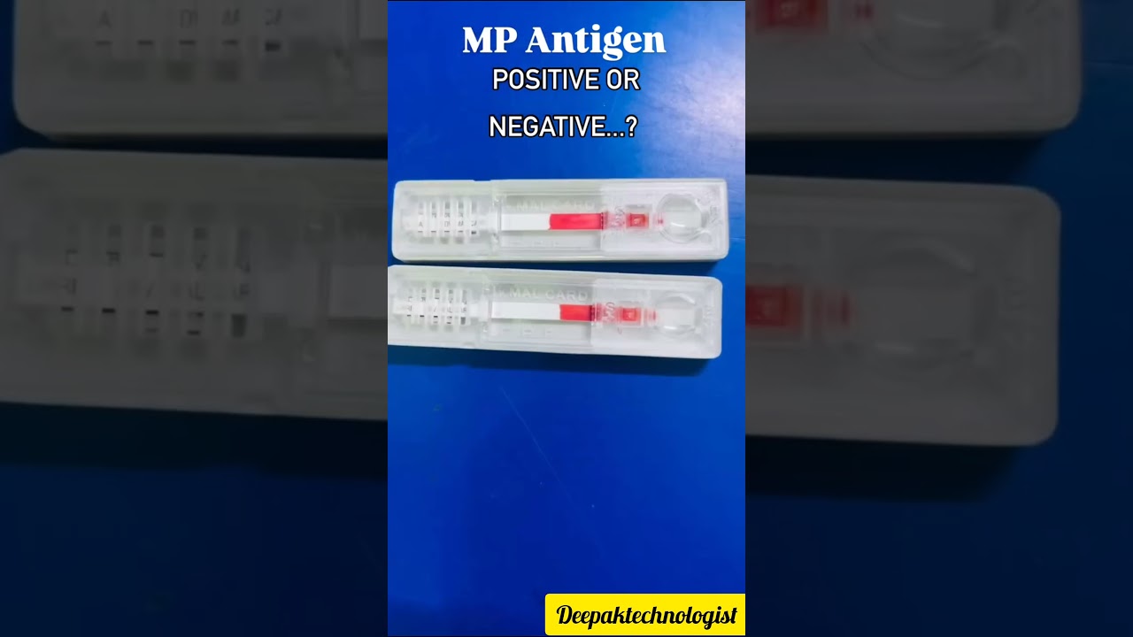 MP antigen #highlights#trending#doctor#ytshorts#labtested#vireo#shirts#microbiologylab#microscopic