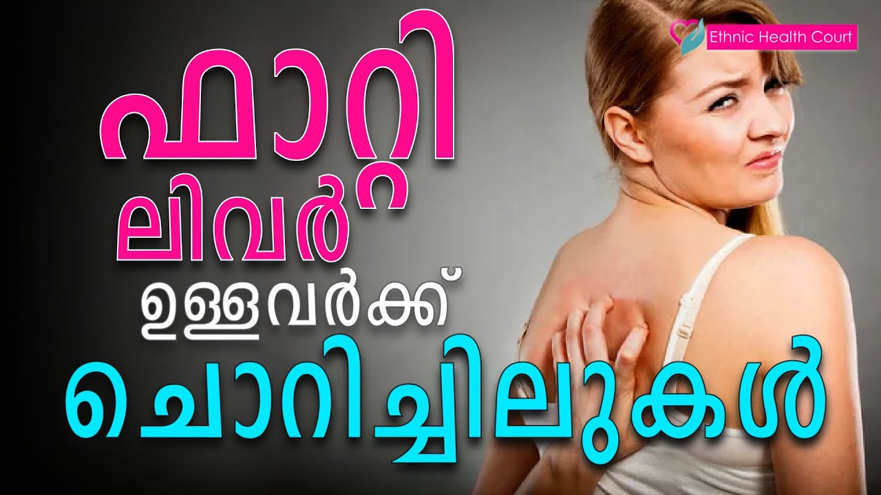 ചൊറിച്ചിലുകൾ ഫാറ്റി ലിവറിന്റെ ലക്ഷണങ്ങളാകാം | Fatty liver | Ethnic Health Court