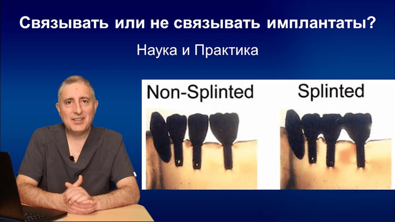Что лучше - одиночные коронки на имплантах или мост?
