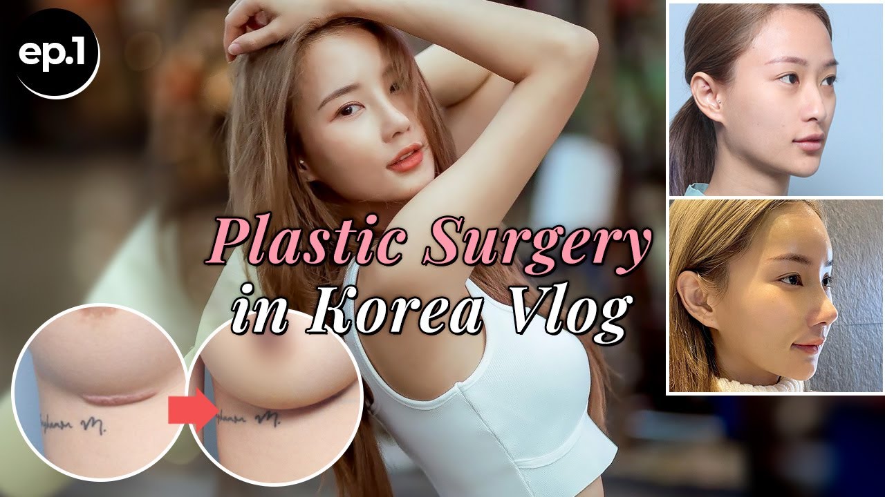 [VLOG] Smooth and Fancy Nosejob & Boobjob in Korea Plastic Surgery Hospital | Experience & Post-OP