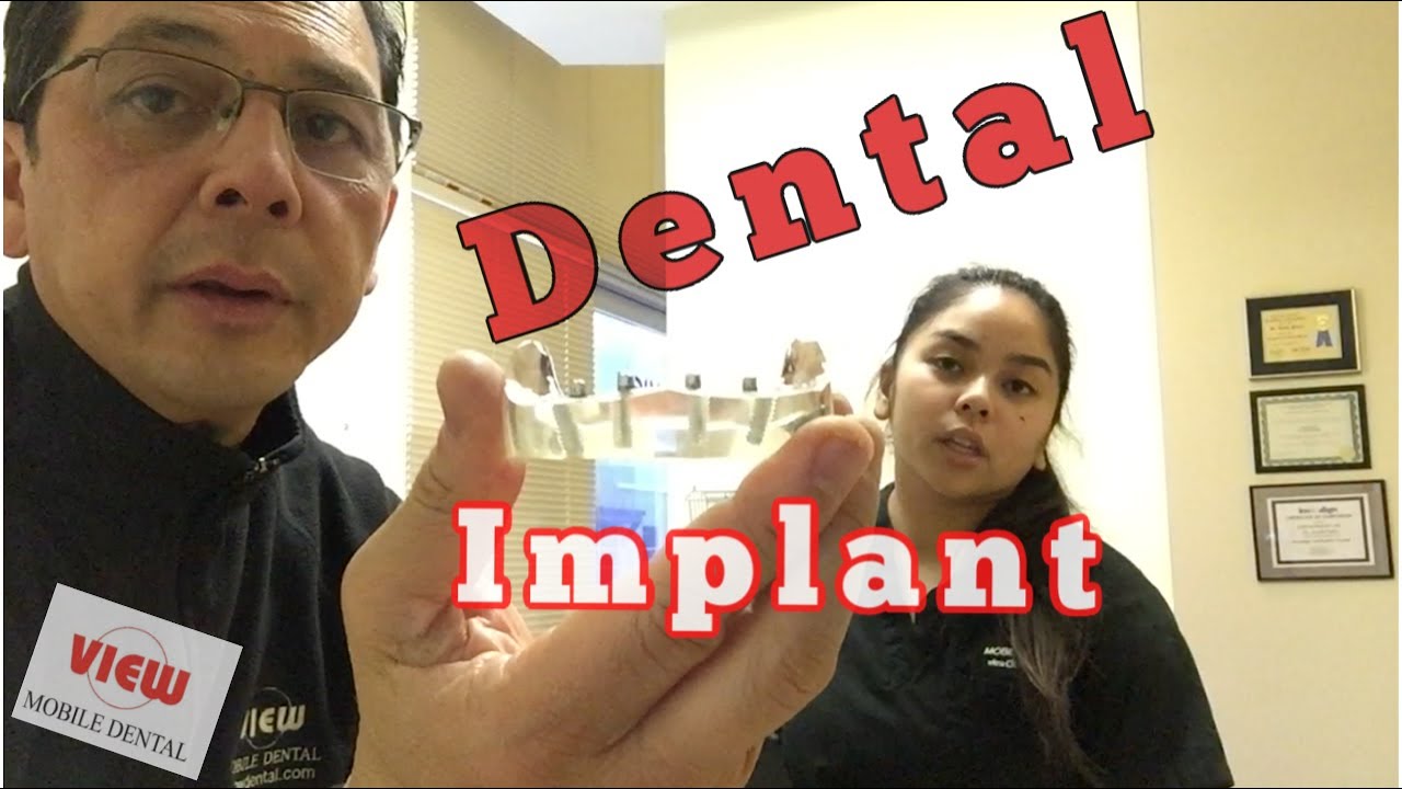 Dental Implant Supported Denture  | View Mobile Dental