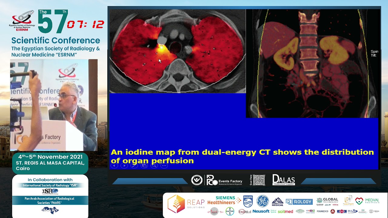 DUAL ENERGY CT