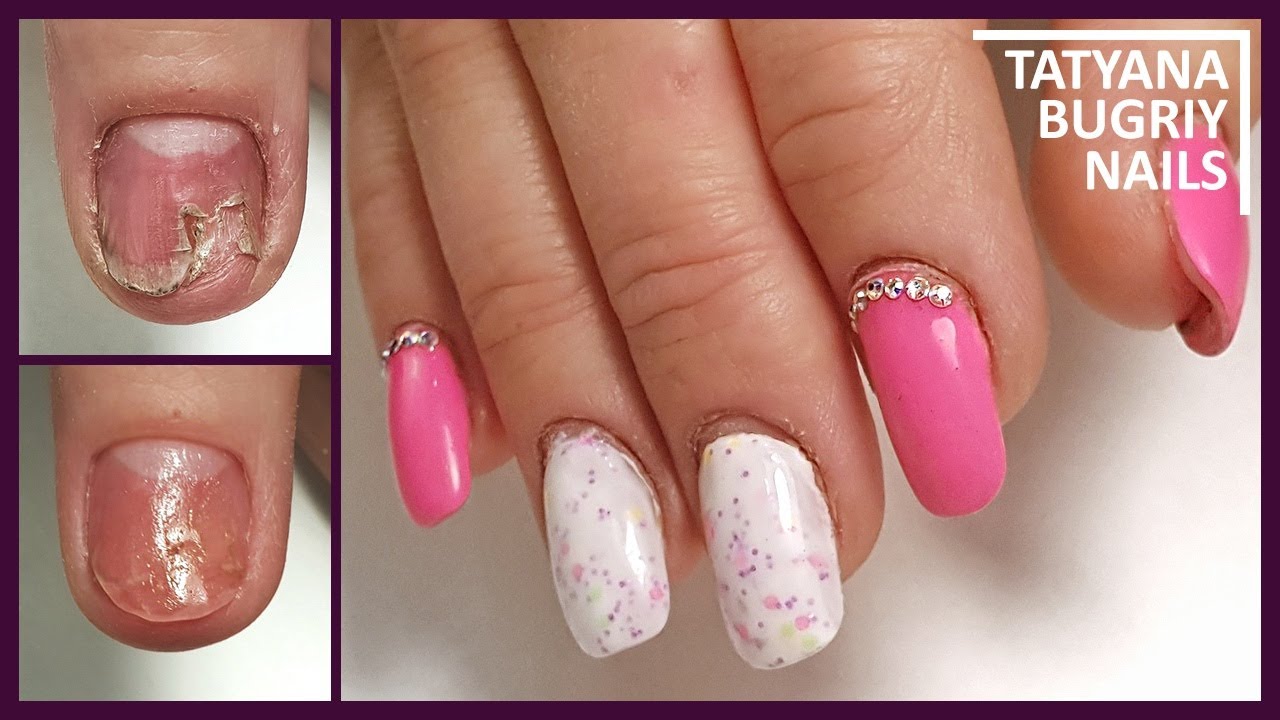 Поврежденный НОГОТЬ как Нарастить/ Ногти Другого МАСТЕРА/ Работа над ОШИБКАМИ