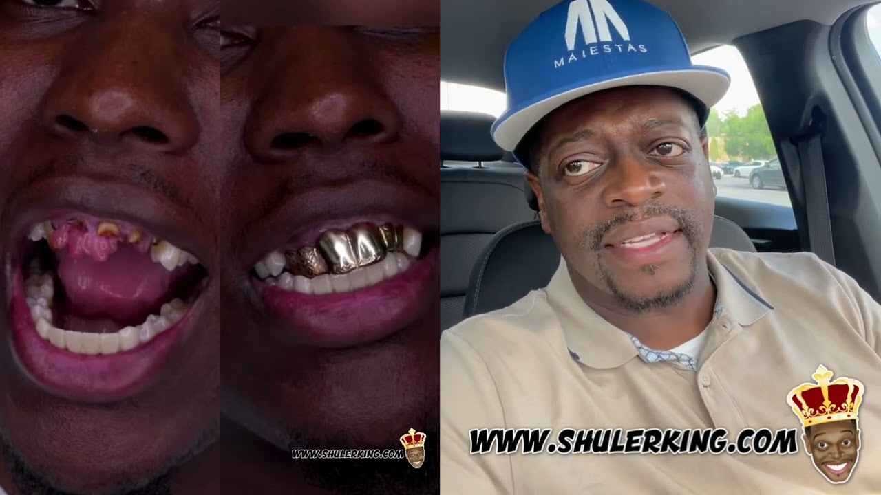 Take Care Of Your Teeth