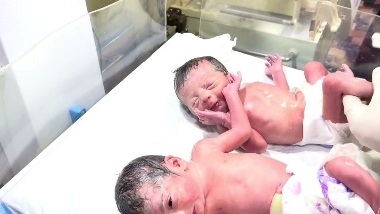 First Moments of Newborn Twin Babies in Hospital | Double Happiness, Double Miracles✨🥰😇 