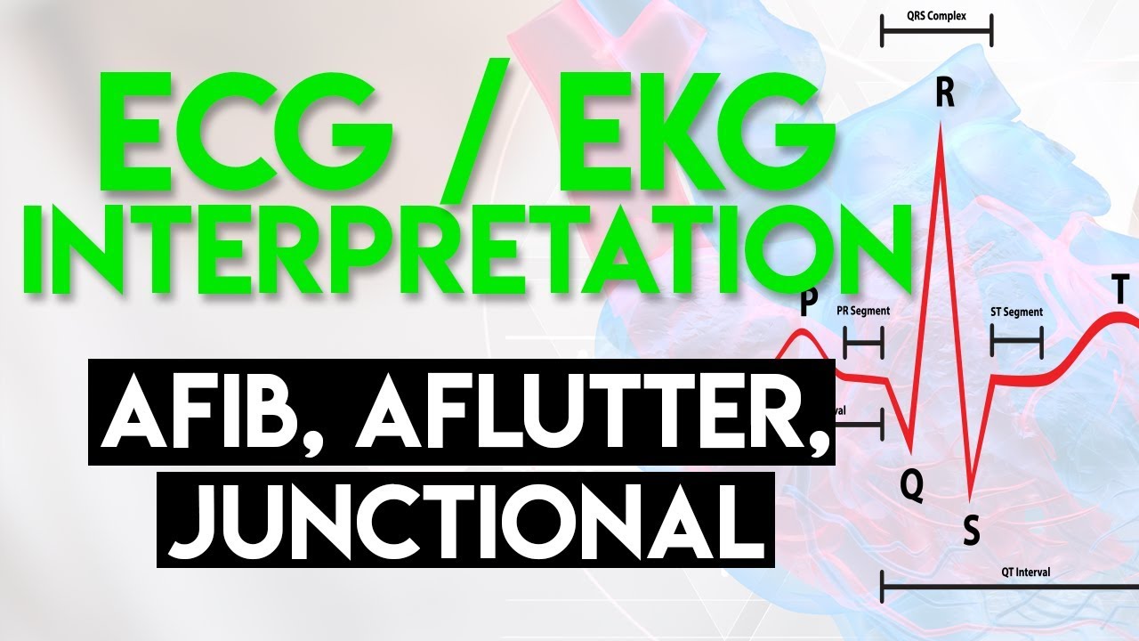 Afib, Aflutter, Junctional Arrhythmias | ECG EKG Interpretation (Part 4)