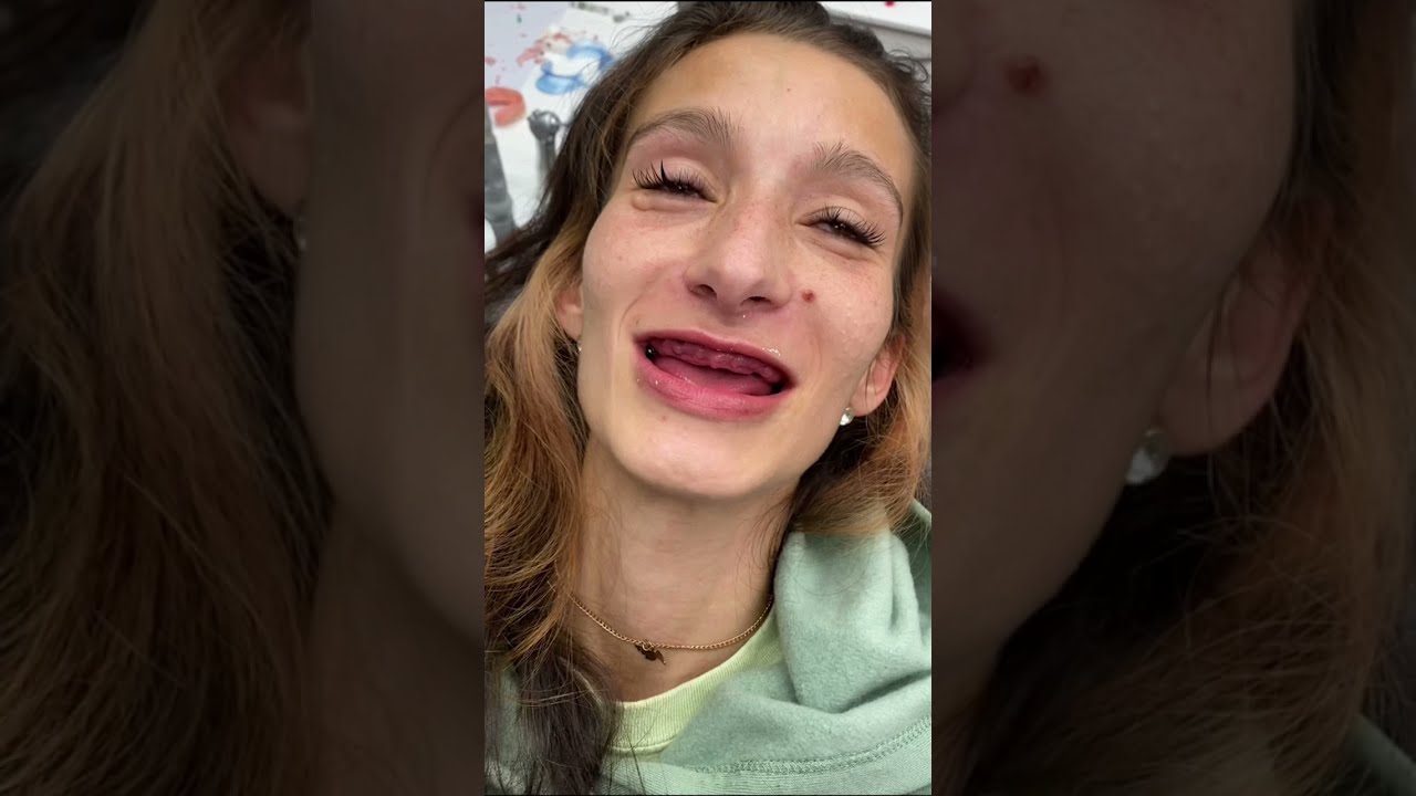 Dentist Gives Woman Who Had Teeth Removed Her Smile Back