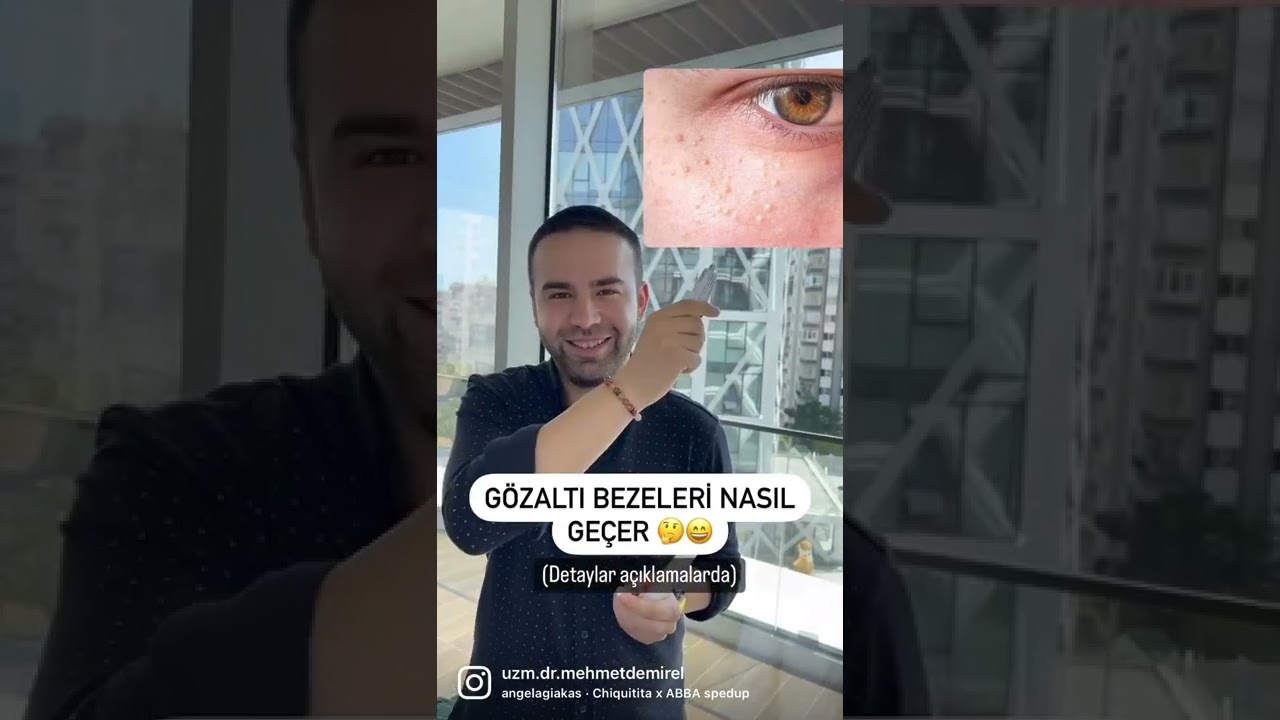 G&ouml;zaltı Bezeleri Nasıl Ge&ccedil;er? @CznBurak style anlattım :) #shorts