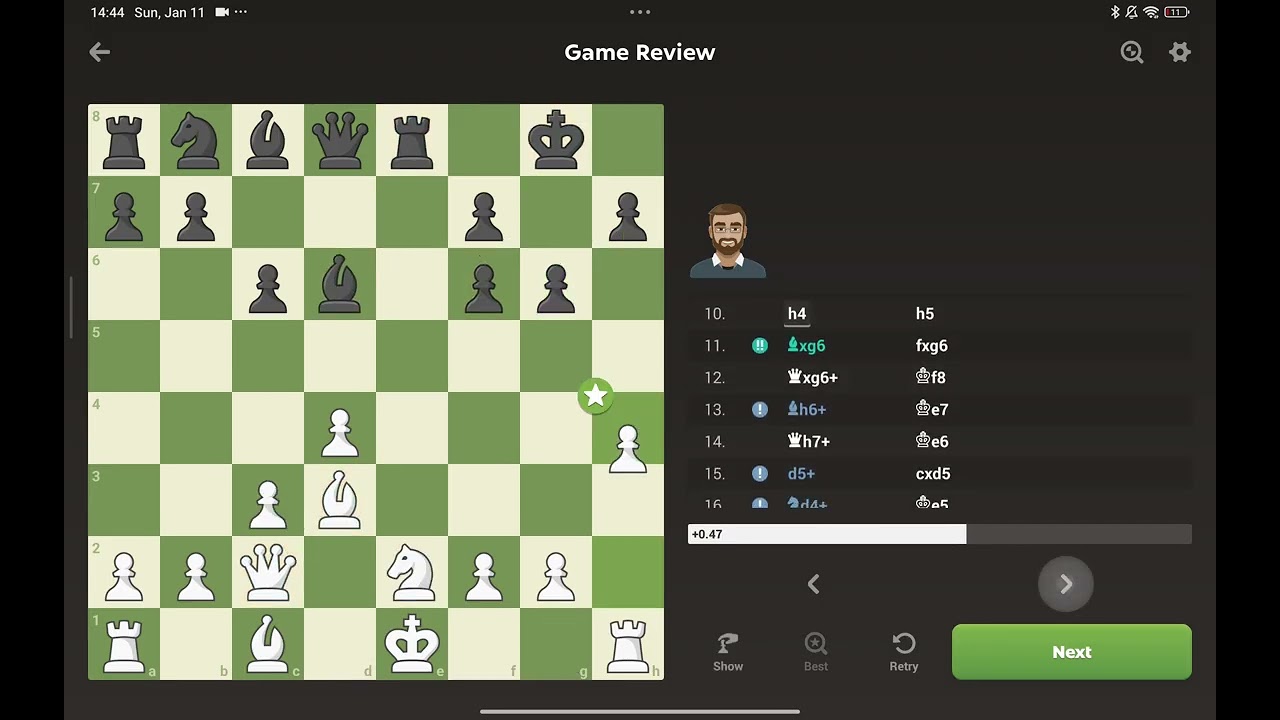 My Best Game in Chess ????!!!! ♟️