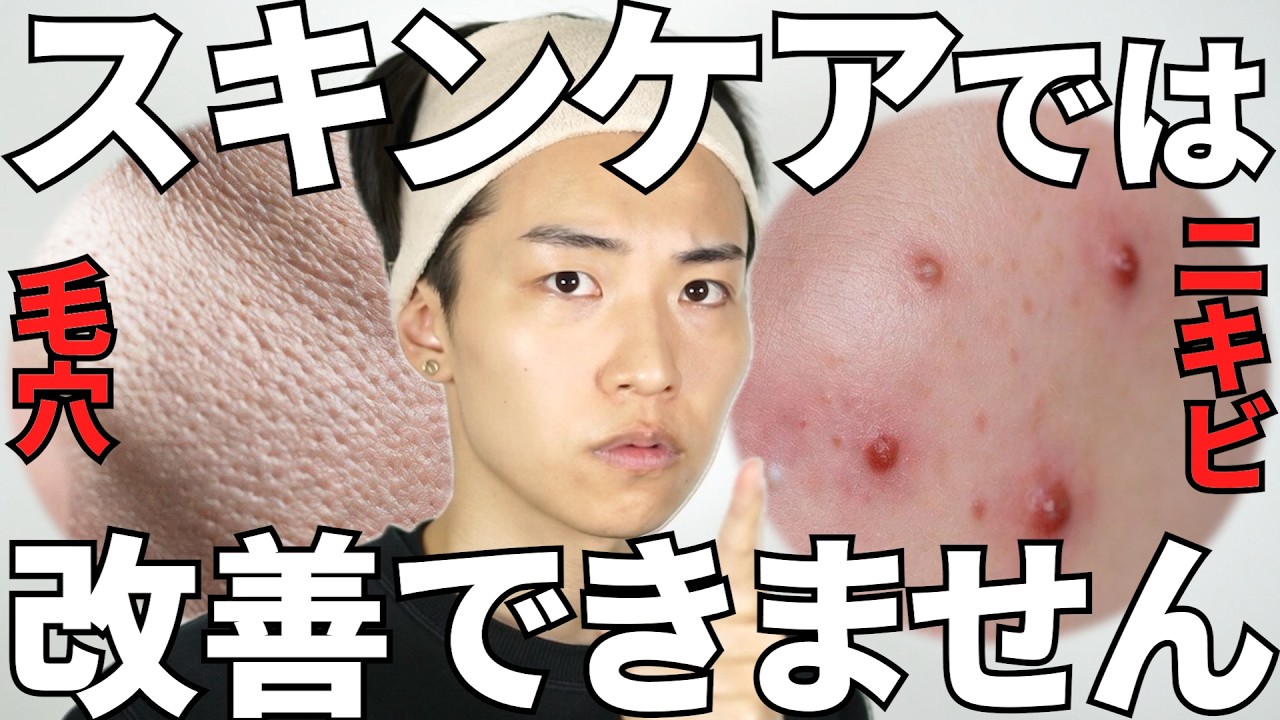 【知っといた方がいい】スキンケアでは限界がある肌悩み５選