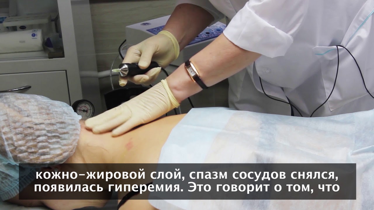 Карбокситерапия в неврологии, медицинский центр 