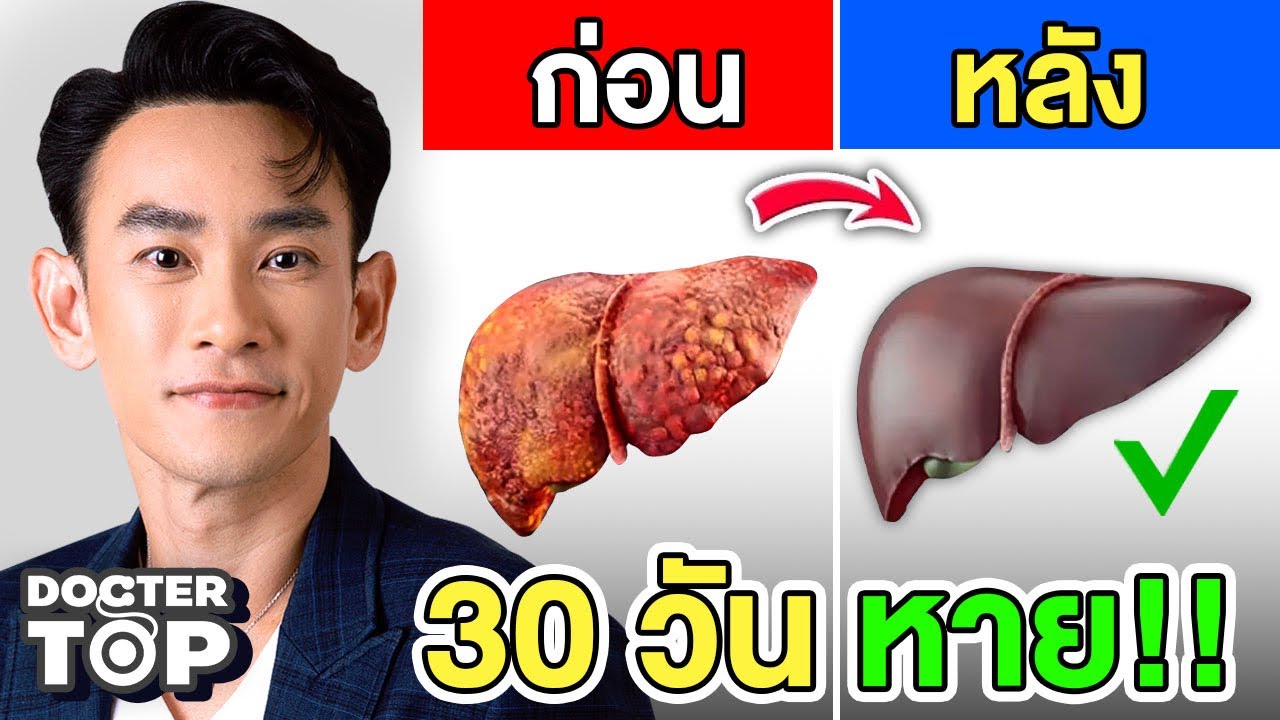 ไขมันพอกตับหายใน 1 เดือน‼️ ( 7 ขั้นตอน ง่าย ไม่ใช้ยา ทำได้จริง ) 😊❤️🌈 | หมอท๊อป 531