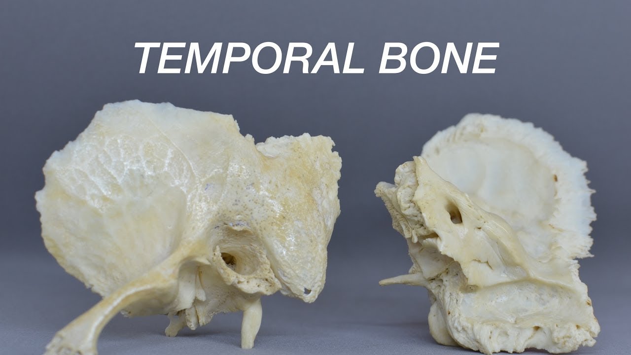 TEMPORAL BONE