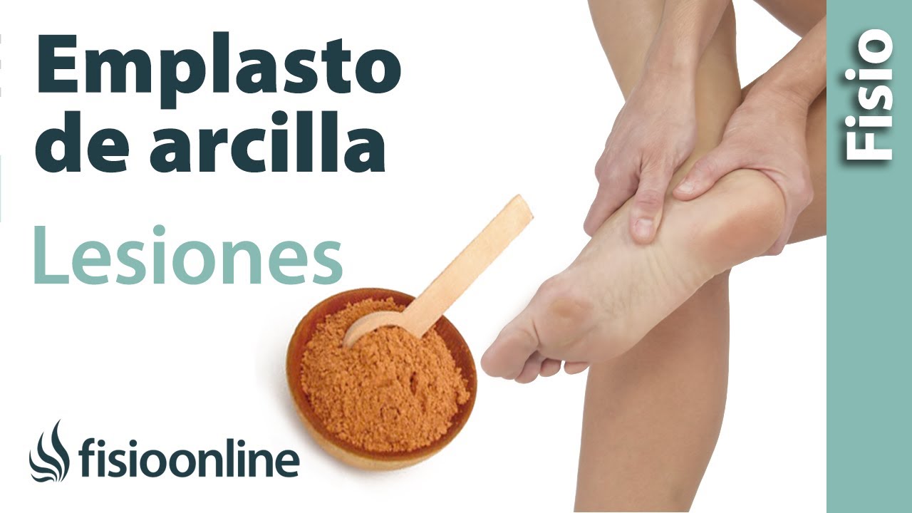 Emplasto de arcilla para esguinces, contusiones, inflamaciones y desgarros musculares