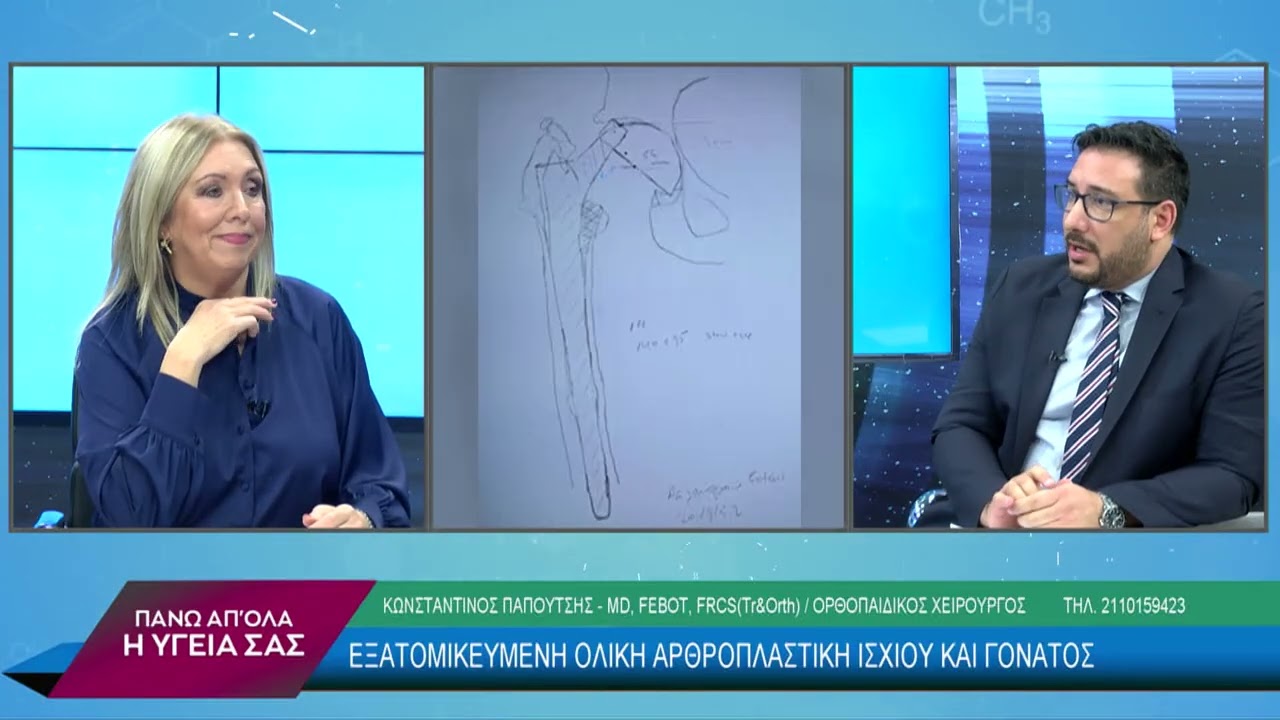 Εξατομικευμένη Ολική Αρθροπλαστική Ισχίου και Γόνατος με τον Κωνσταντίνο Παπουτσή.