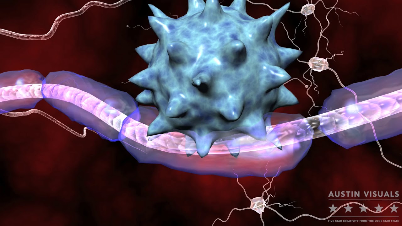 Multiple Sclerosis. Austin Visuals