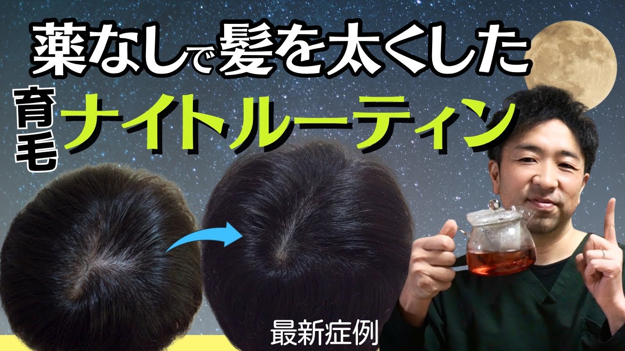 【老化を食い止めろ】薄毛改善のナイトルーティン&寝る前のお勧め抗酸化ドリンク！薬無しで発毛した男性が実践した帰宅〜就寝までの育毛習慣を紹介します