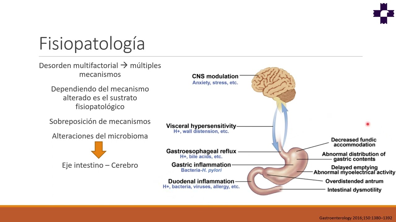 Dispepsia