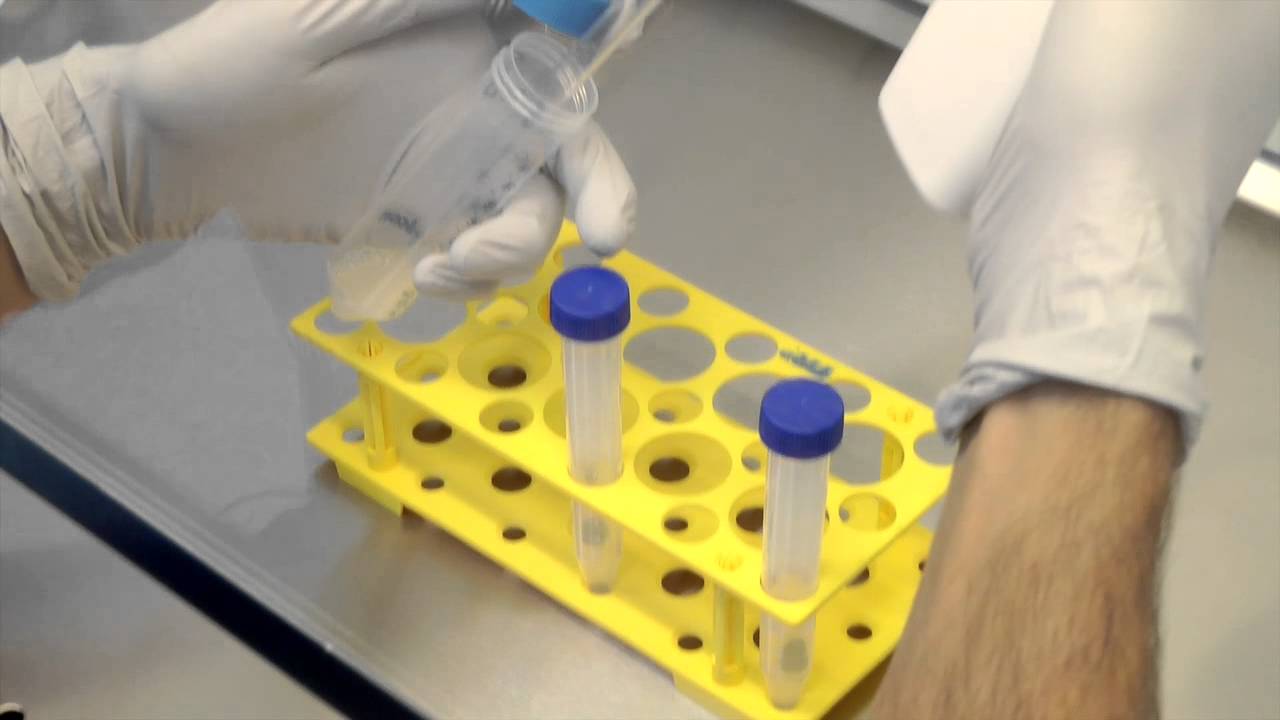 Sperm preparation by Vitrolife - short protocol