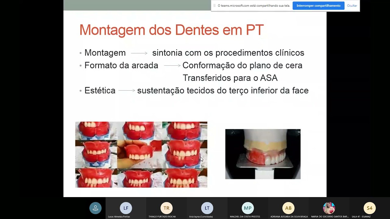Aula 7 (22.04.21) - Montagem dos Dentes, Ceroplastia e Acrilização da Prótese Total