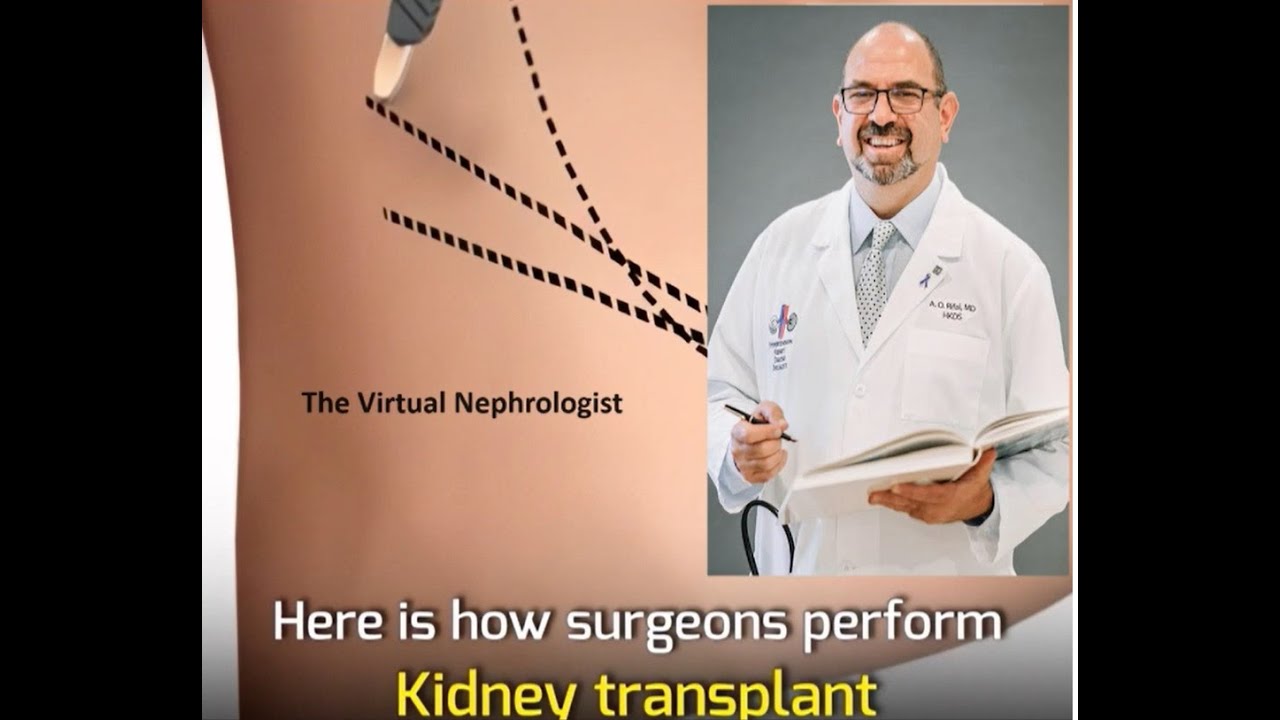 How a Kidney Transplant is performed, step by step explained | The Virtual Nephrologist | Dr. Rifai
