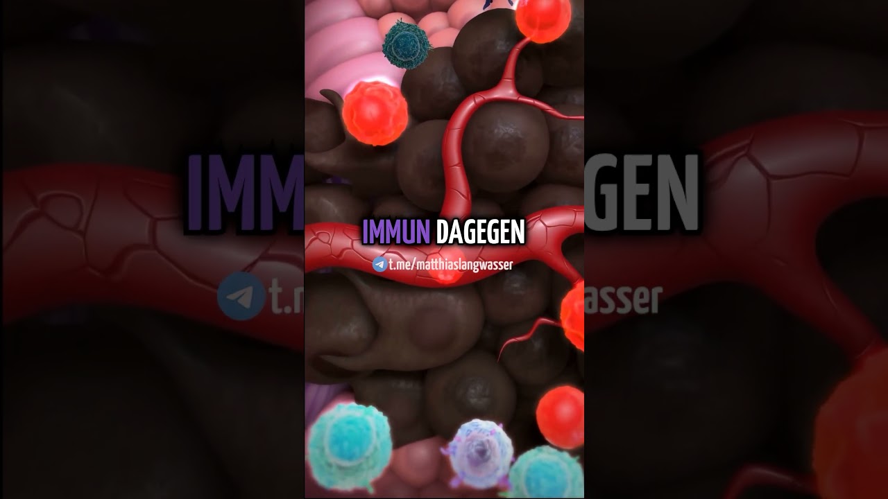 Ist es Ersch&ouml;pfung? Oder geht es tiefer?