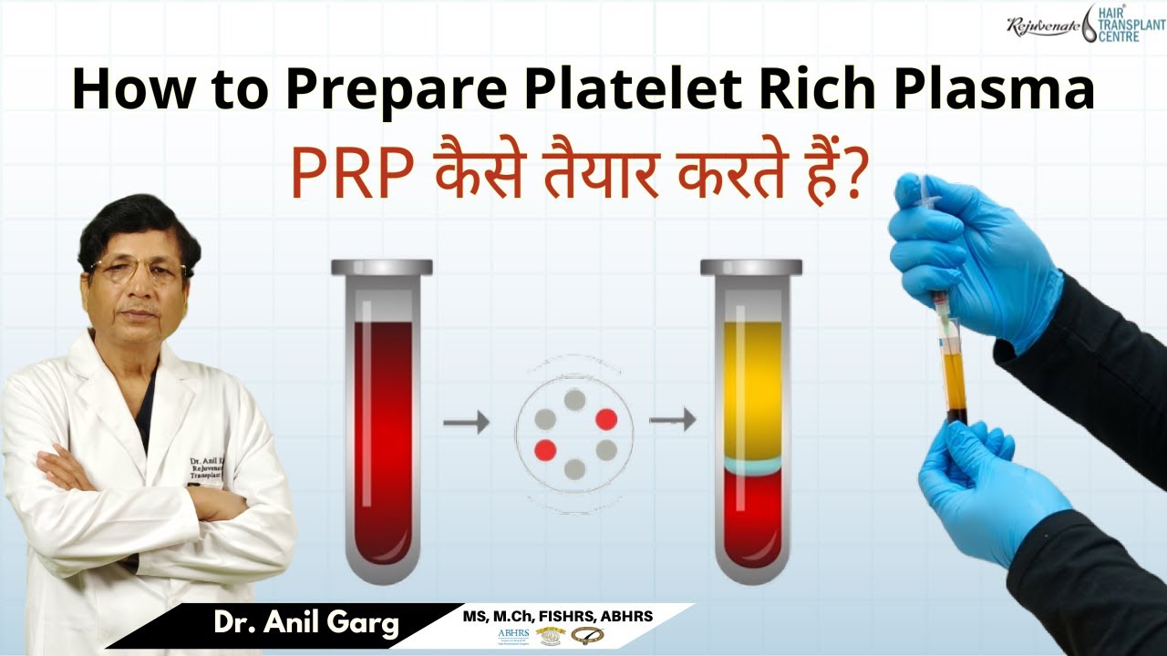HOW TO PREPARE PRP ( Platelets Rich Plasma ) | PRP कैसे तैयार होता है