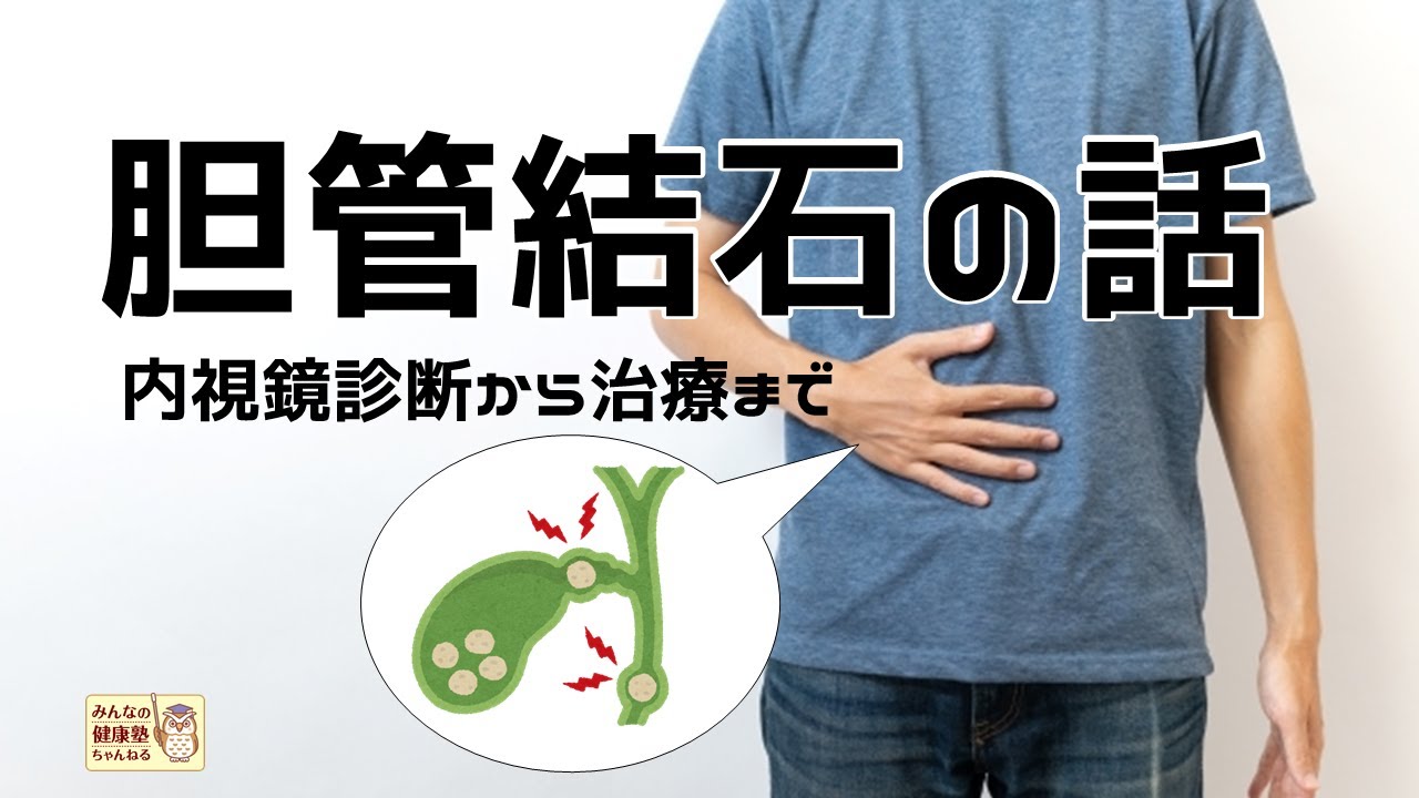 胆管結石の話 ～内視鏡診断から治療まで～