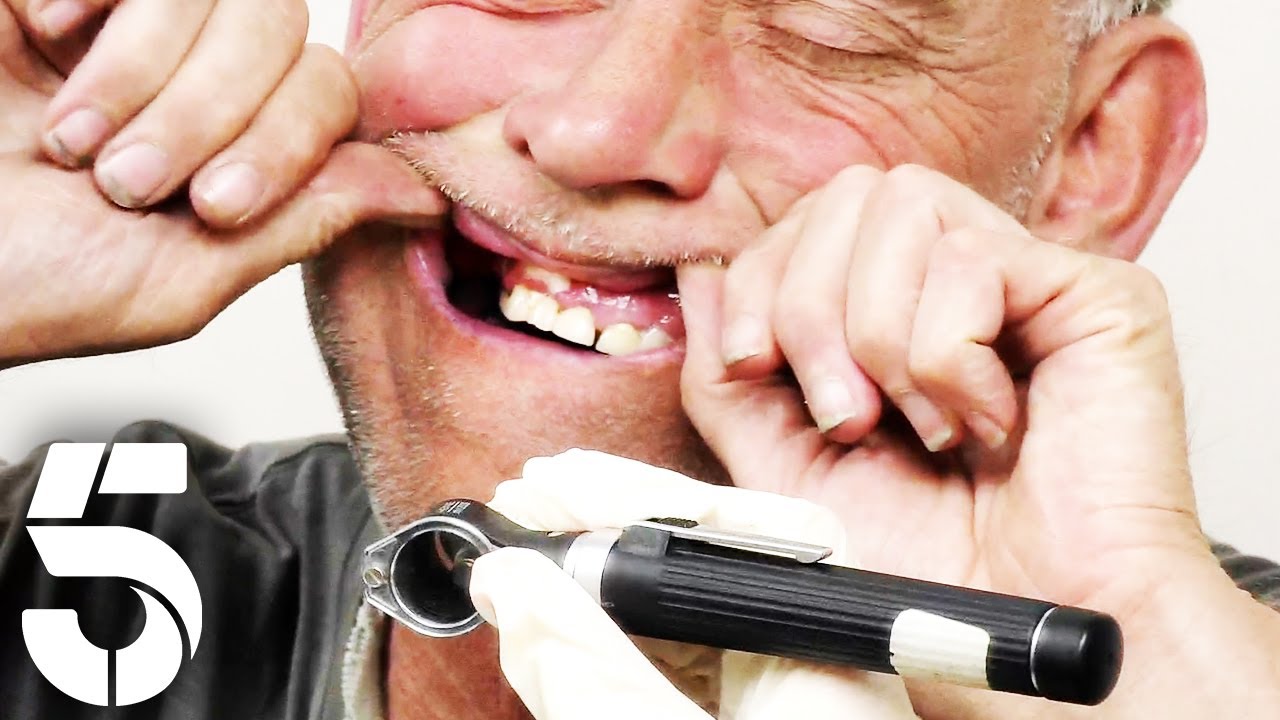 My Mouth Is Swollen | GPs: Behind Closed Doors | Channel 5