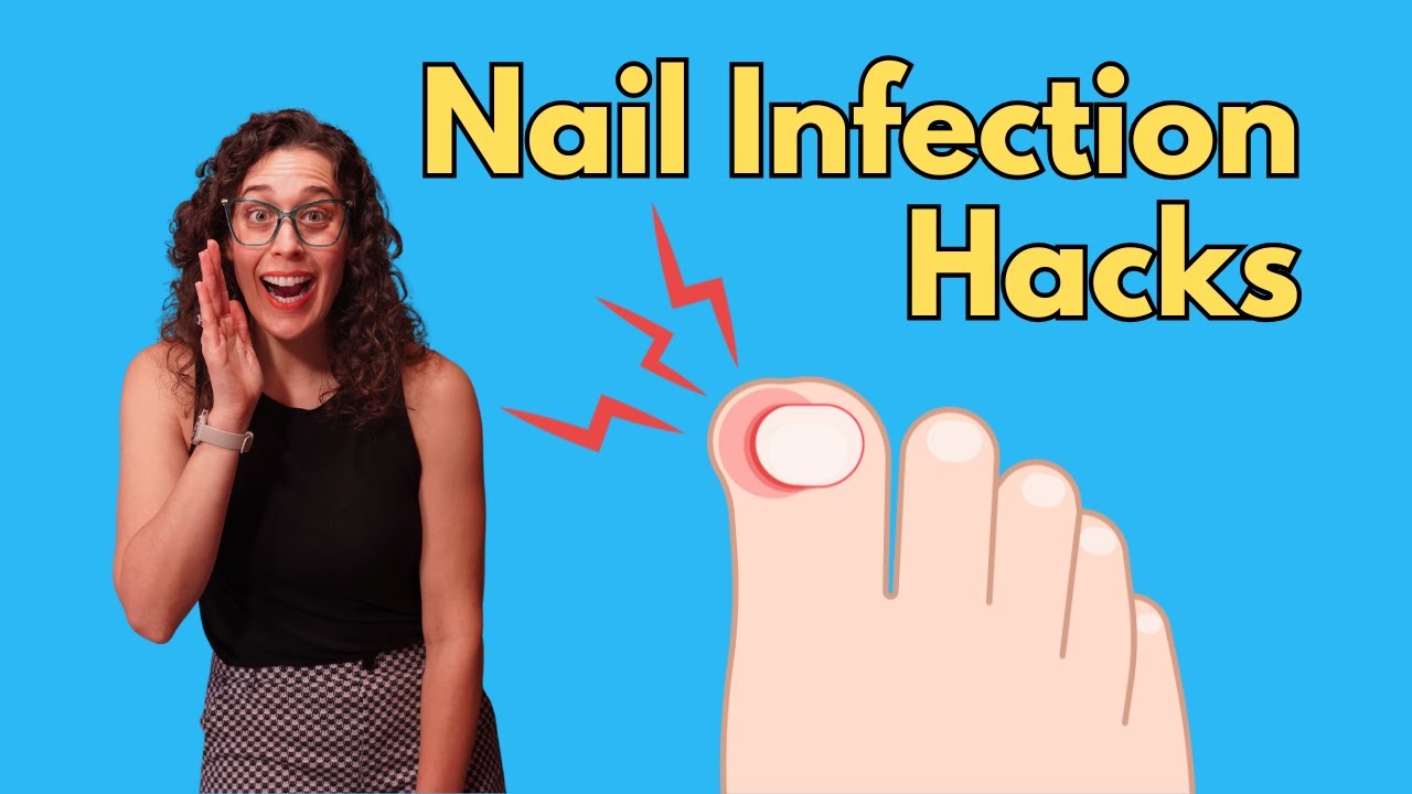 How to Treat and Prevent Paronychia: Nail Care Tips and Tricks| Dr. Victoria, MD