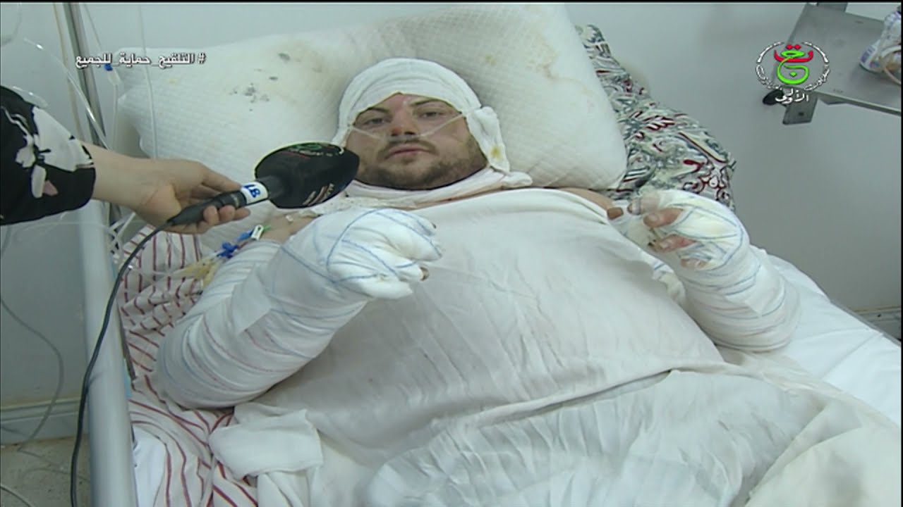 مستشفى الدويرة - العاصمة / تكفل الأطباء بالمصابين جراء الحرائق