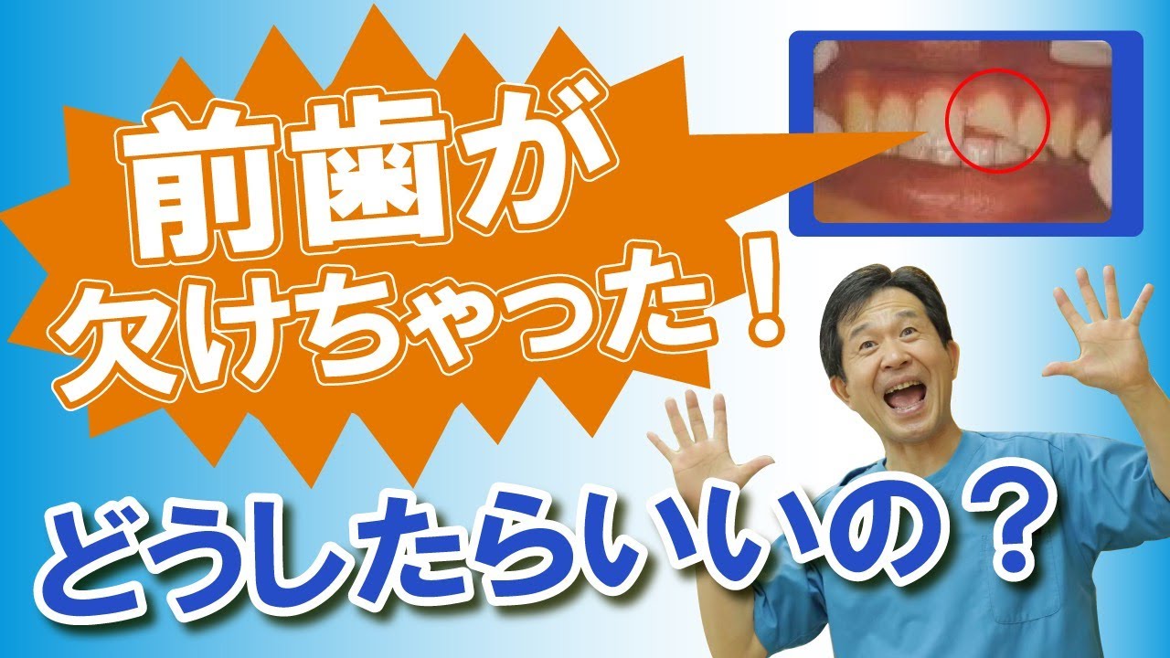前歯が半分欠けた！どうしたら良いの？ 歯医者がわかりやすく解説!!